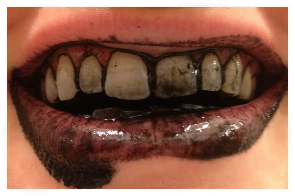 Whitening Your Teeth With Activated Charcoal